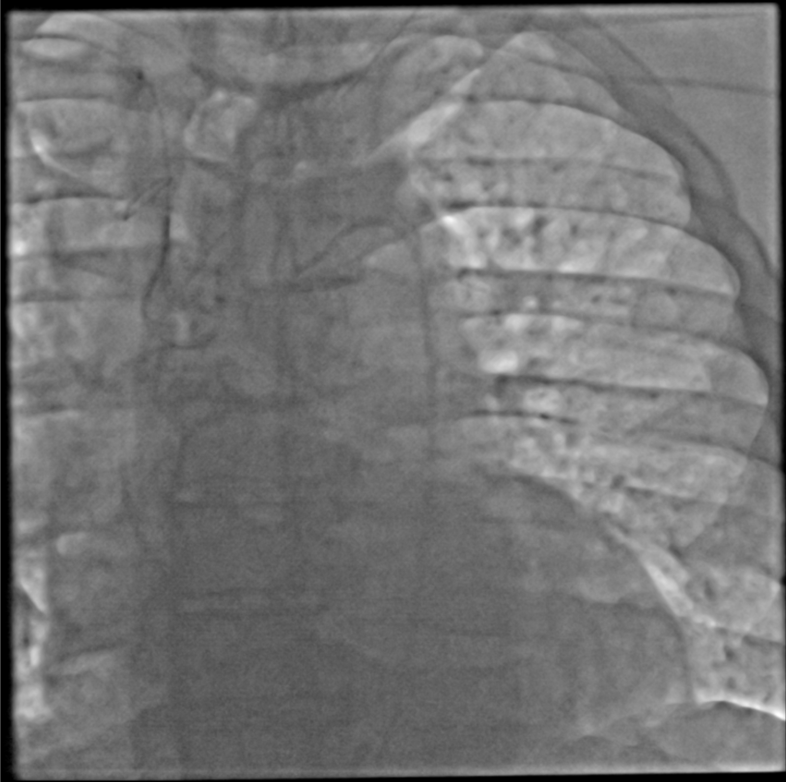 X-ray Test Plates - Image 4
