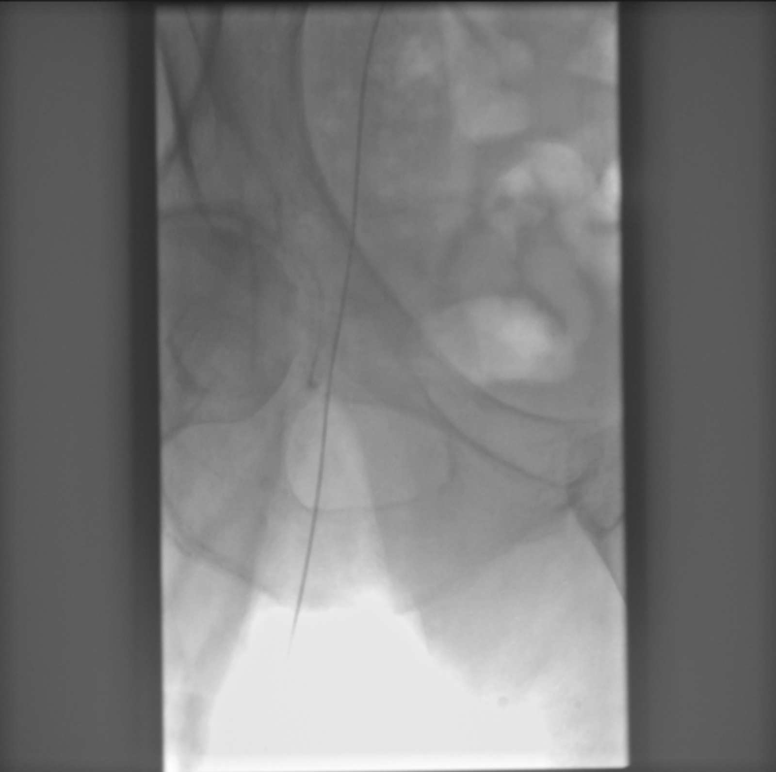 X-ray Test Plates - Image 5